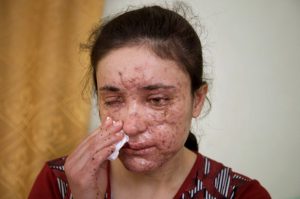 আল্লাহর আইন চাই ও একজন হাজী মোহাম্মাদ মহসিন Domestic violence